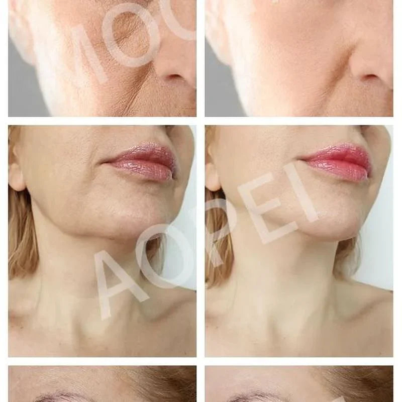 Retinol Anti Wrinkle Eye Cream Remove Eye Bags Puffiness Dark Circles Whitening Moisturizing Eyes Skin Care Cosmetics