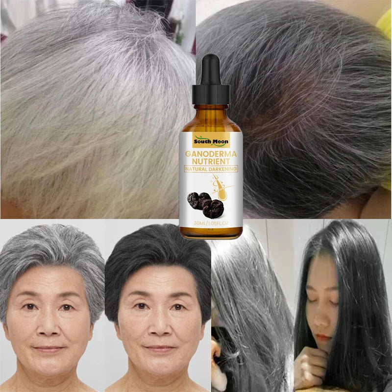 Gray White Hair Treatment Serum Liquid White To Black Natural Color Repair Nourish Products Anti Loss Hair Care for Men Women