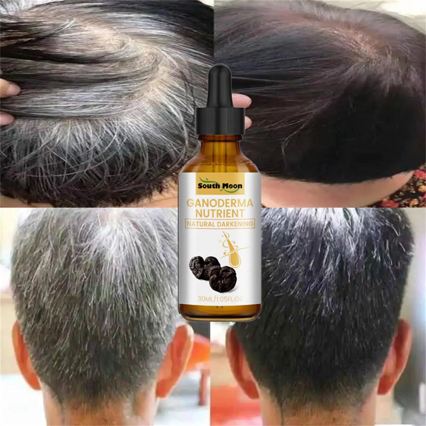 5PCS Anti Gray Hair Care Serum White To Black Natural Color Repair Damaged Hair Darkening Anti Loss Nourishing For Women And Men